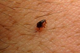 Small Flea — Surekil Pest Control In Tweed Heads, NSW