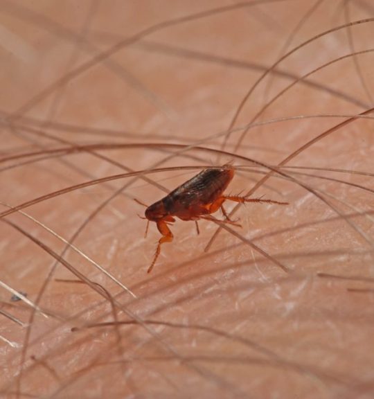 flea crawling on human skin through hairs